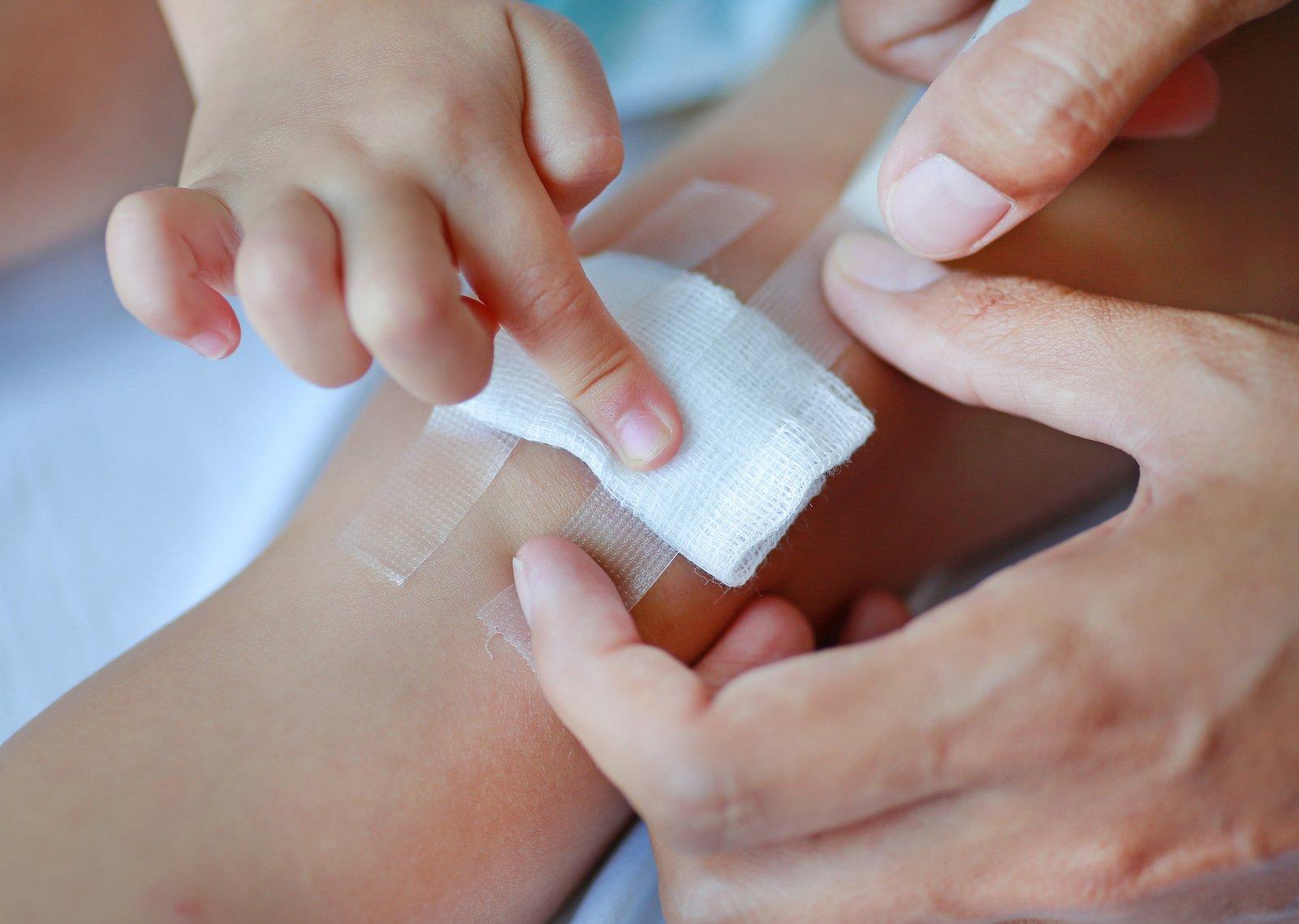 When a Wound Needs Medical Attention and What to Do Next